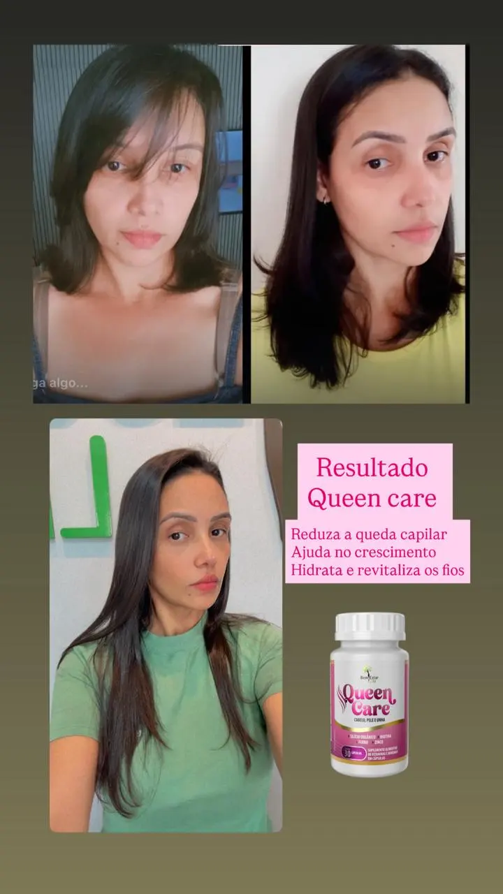 RESULTADO VITAMINA QUEEM CARE